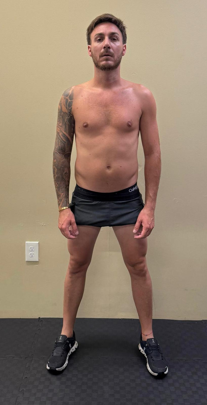 Before transformation